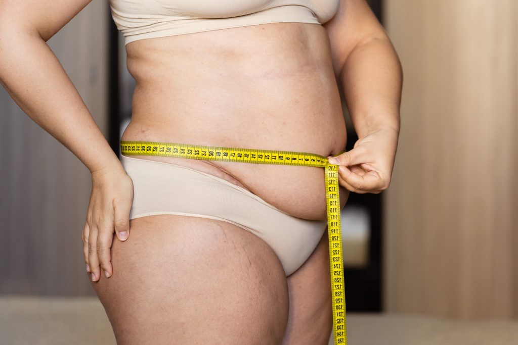 Hızlı ve Etkili Kilo Kaybı: Sağlıklı bir yaşama hızlı adapte olma şansı.Gastric Bypass Ameliyatı,Obezite Cerrahisi